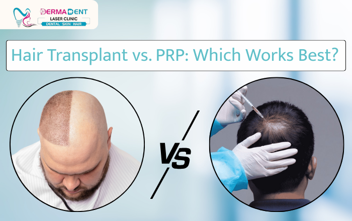 Hair Transplant vs. PRP Therapy: Which Hair Loss Treatment Works Best for You?