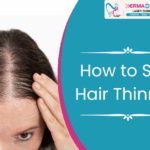How to Stop Hair Thinning Before It Gets Worse