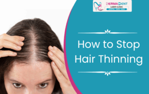 How to Stop Hair Thinning Before It Gets Worse
