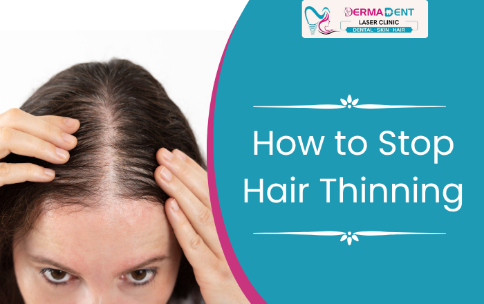 How to Stop Hair Thinning Before It Gets Worse