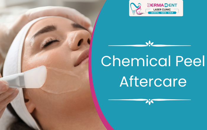 Chemical Peel Aftercare: What to Do and Avoid
