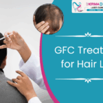 GFC Treatment for Hair Loss: What It Is and How It Helps