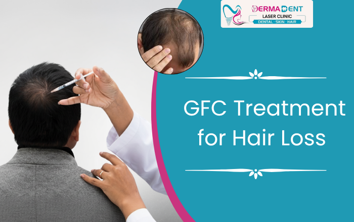 GFC Treatment for Hair Loss: What It Is and How It Helps