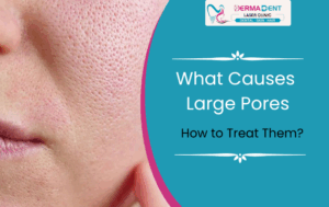 What Causes Large Pores and How to Treat Them Effectively