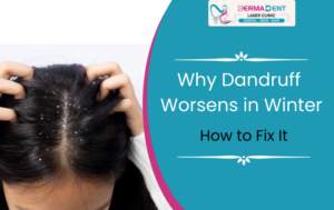 Why Dandruff Gets Worse in Winter & How to Fix It Fast