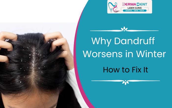 Why Dandruff Gets Worse in Winter & How to Fix It Fast