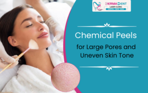 Chemical Peels for Large Pores and Uneven Skin Tone