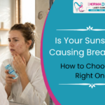 Is Your Sunscreen Causing Breakouts? How to Choose the Right One