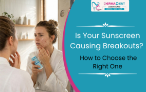 Is Your Sunscreen Causing Breakouts? How to Choose the Right One