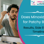 Does Minoxidil Work for Patchy Beard? Results, Side Effects & Timeline