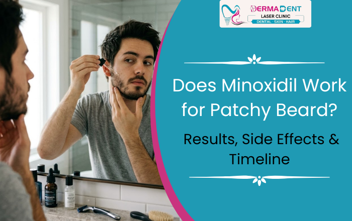 Does Minoxidil Work for Patchy Beard? Results, Side Effects & Timeline