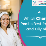 Which Chemical Peel Is Best for Acne and Oily Skin?